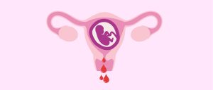 Es normal el sangrado en el primer mes de embarazo  Es normal el sangrado en el primer mes de embarazo Sangrado vaginal en el embarazo 300x128