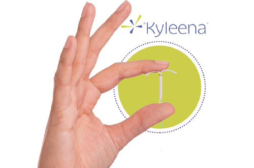 Kyleena El nuevo Dispositivo Intrauterino (DIU) kyleena el nuevo dispositivo intrauterino (diu) Kyleena El nuevo Dispositivo Intrauterino (DIU) DIU 1