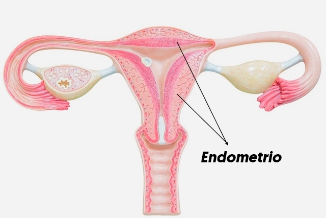 Cáncer de Endometrio Zapopan cáncer de endometrio zapopan Cáncer de Endometrio Zapopan CANCER 2