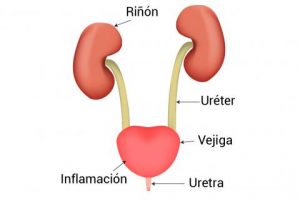 Síntomas de una Infección Urinaria Guadalajara síntomas de una infección urinaria guadalajara Síntomas de una Infección Urinaria Guadalajara infeccion 1 1 300x201