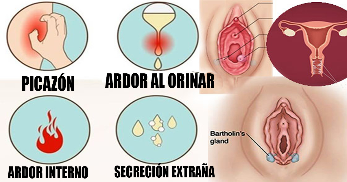Infecciones Vaginales Guadalajara infecciones vaginales guadalajara Infecciones Vaginales Guadalajara INFECCIONES 3