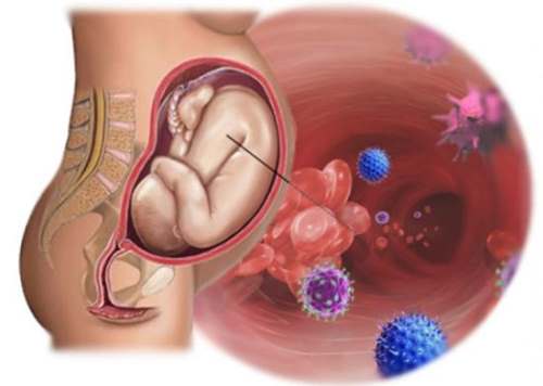 Infecciones en el Embarazo Guadalajara infecciones en el embarazo guadalajara Infecciones en el Embarazo Guadalajara infeccion 1