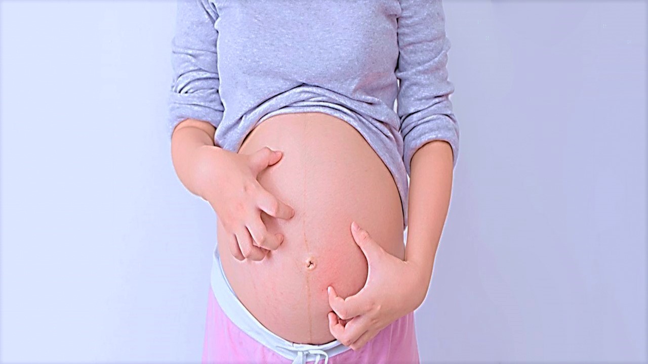 El VPH Durante el embarazo Guadalajara el vph durante el embarazo guadalajara El VPH Durante el embarazo Guadalajara El VPH Durante el embarazo como tratarlo Y c  mo podr  a afectar al beb